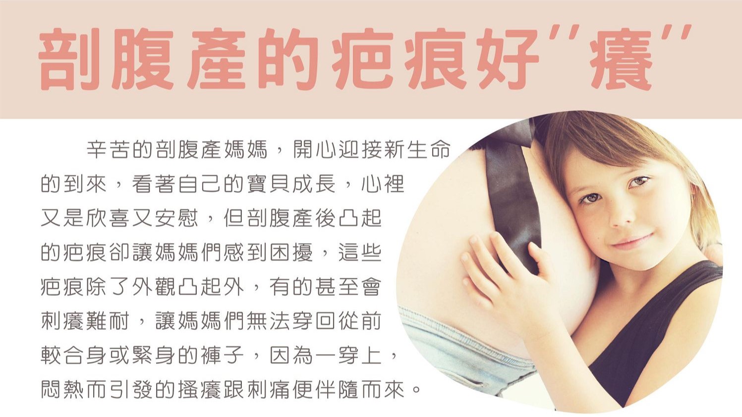 剖腹產疤痕