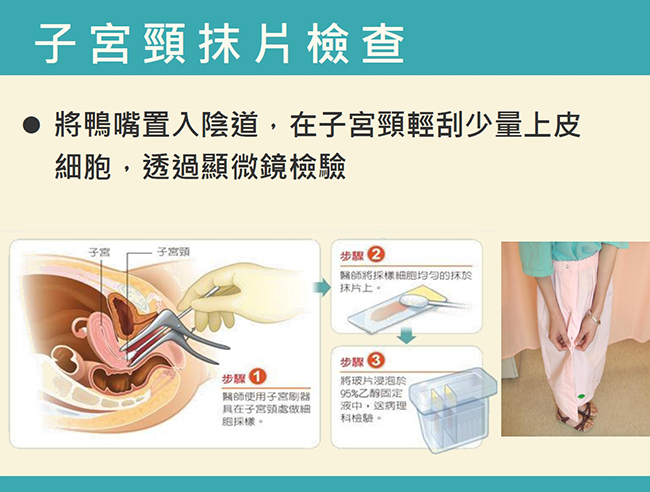 子宮頸抹片檢查